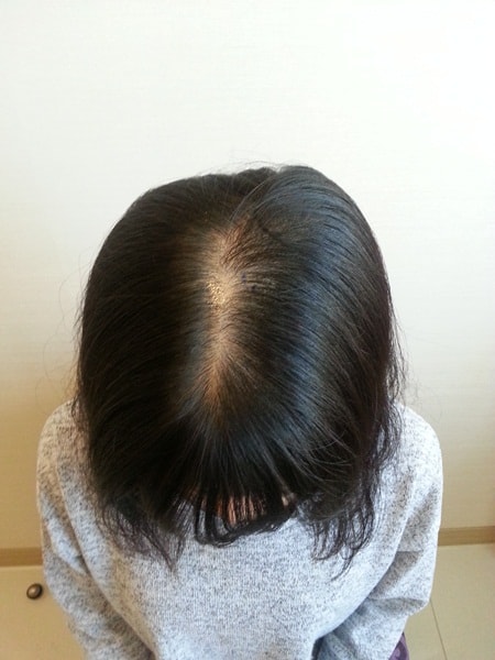 DMP 받은지 벌써 2년.....은 아니고 2개월 후기!