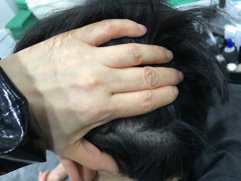 2차 리터치 전