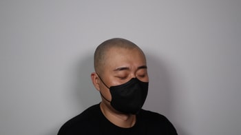 시술 후_좌반측면