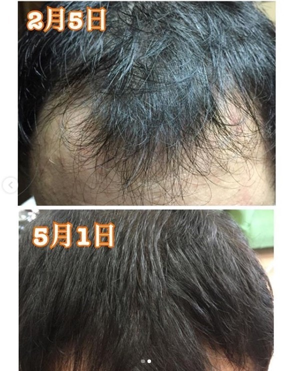 시스 hsc + hsc15후기!!