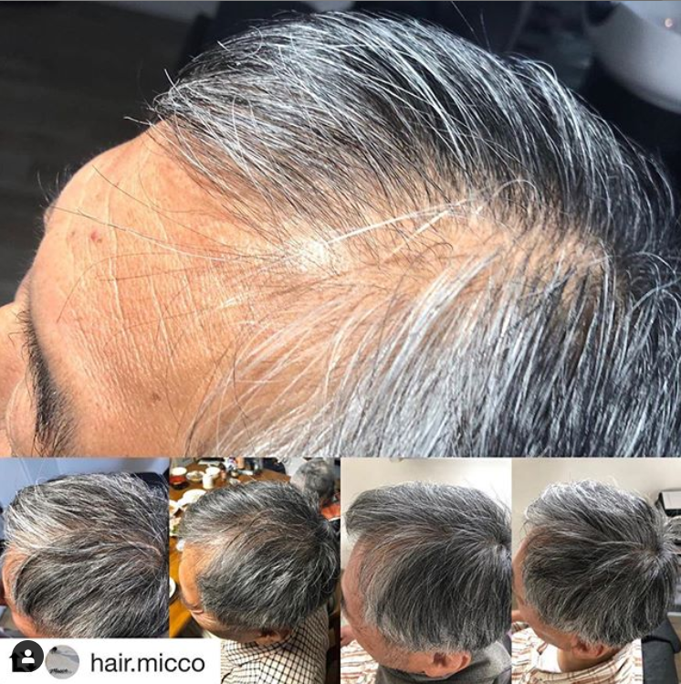 남성탈모(60대)사용후기