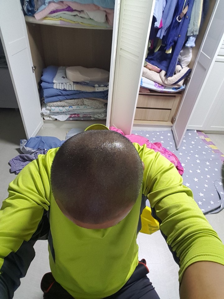 2회 리터치 후