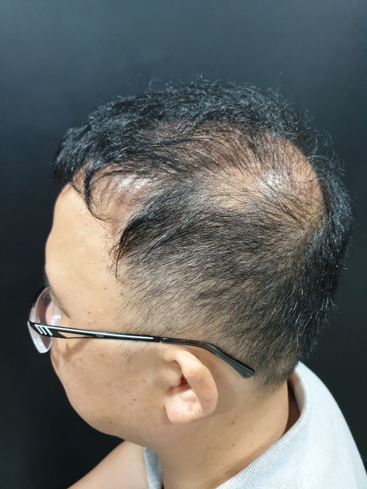 두피문신전 사진