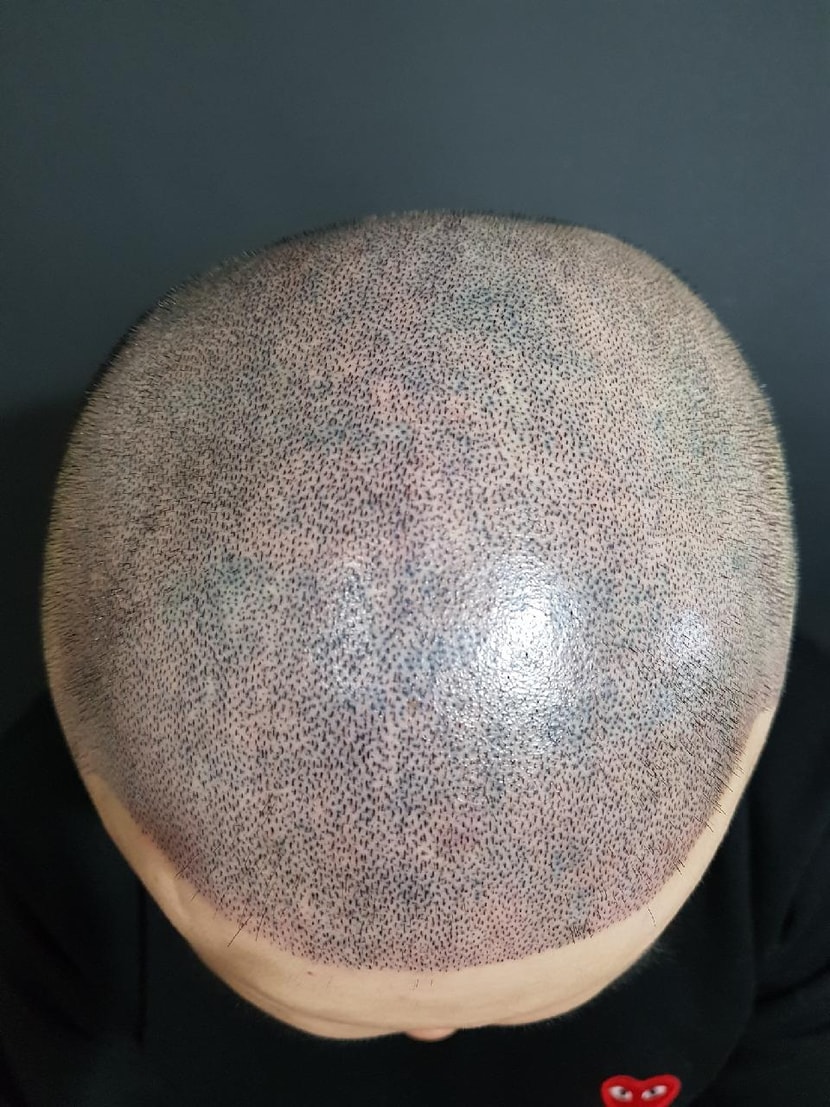 2차 리텃이구요