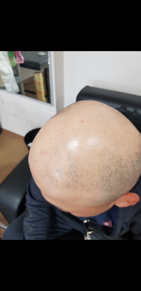 원래머리상태요. 심각하죠