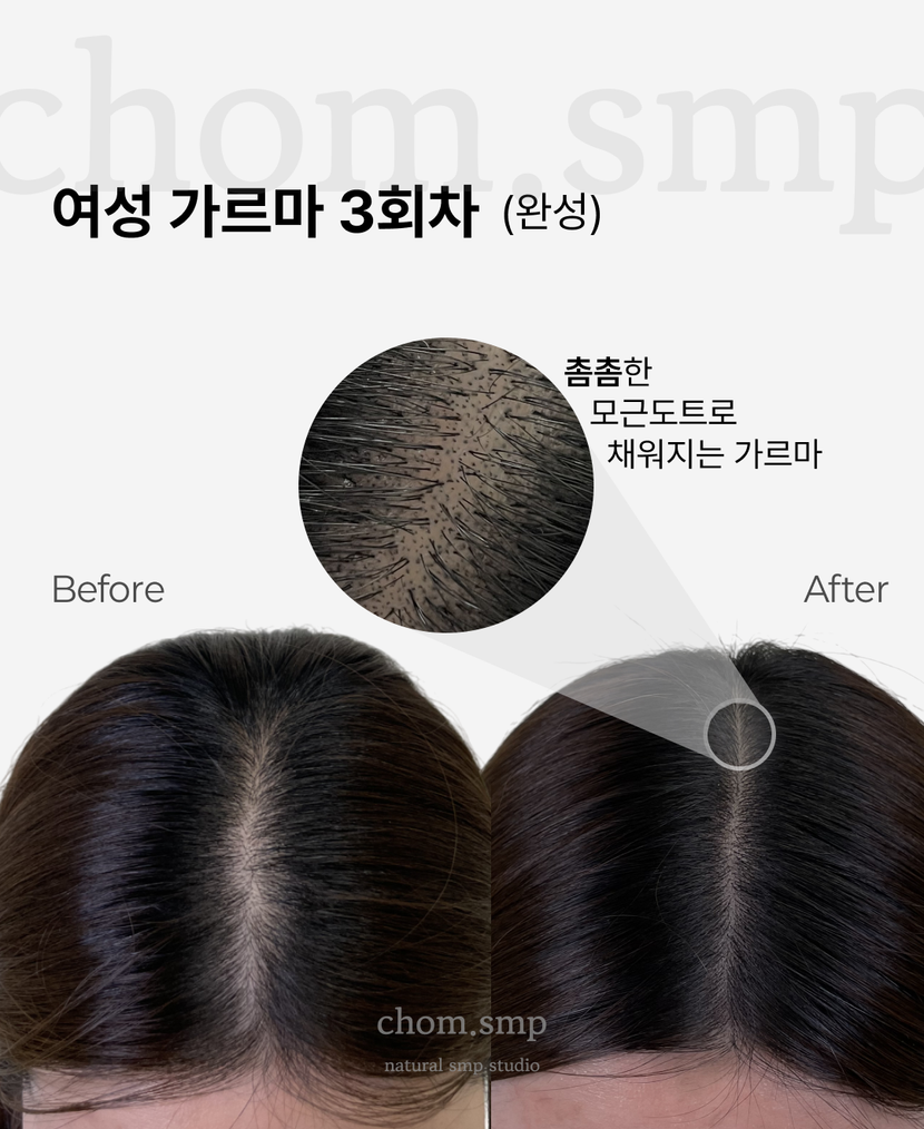 여성 가르마
