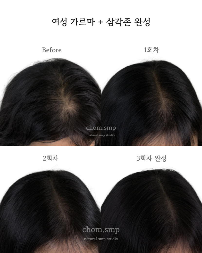 여성 가르마 +삼각존