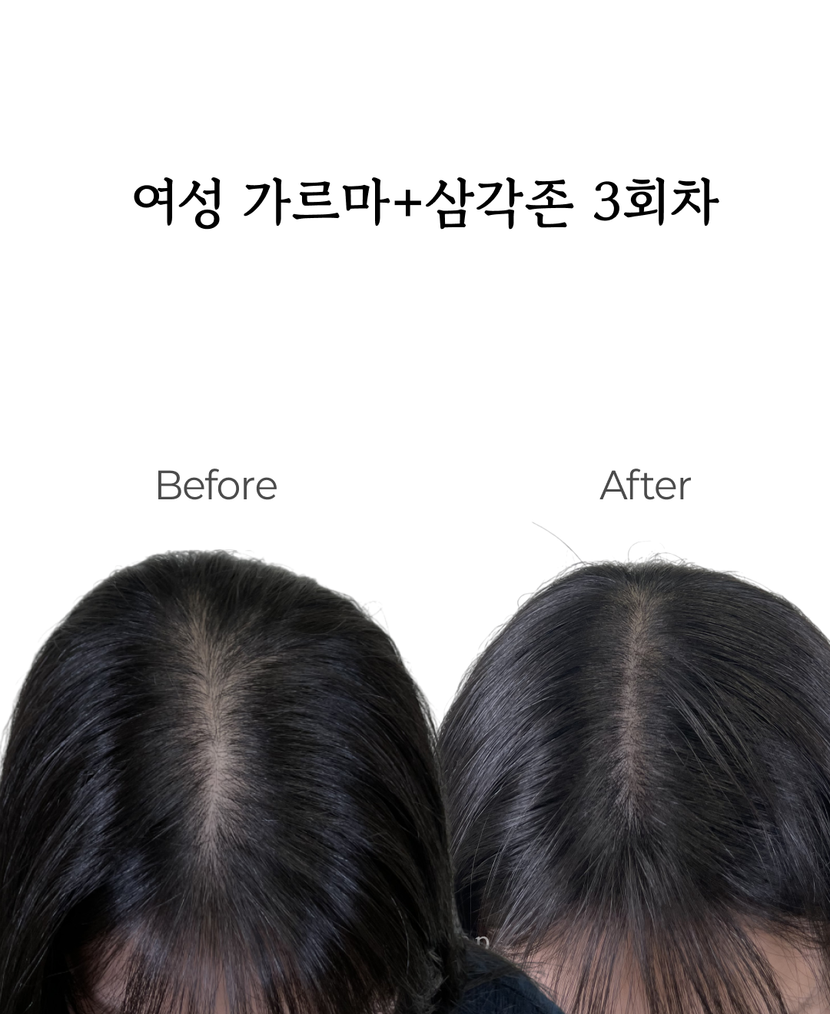 여성 가르마+삼각존