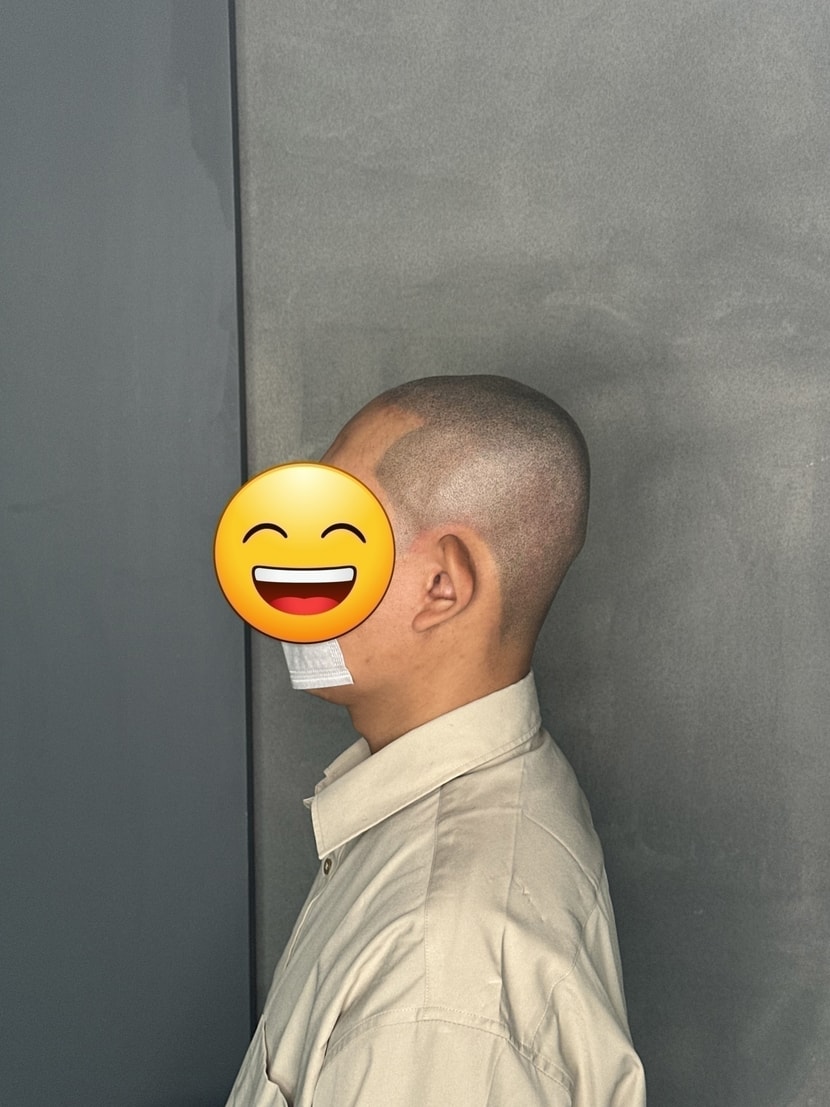 시술 직후 조명 O