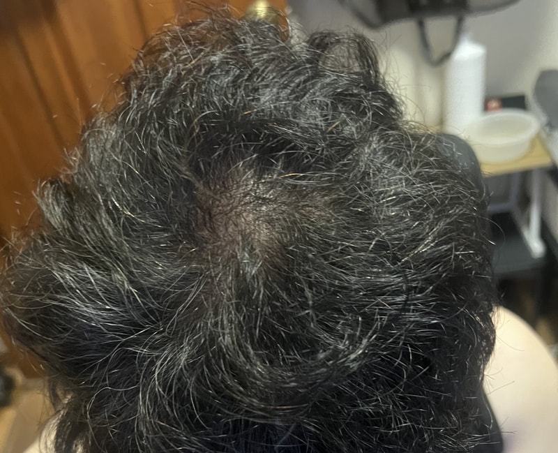 想知道头皮纹身。