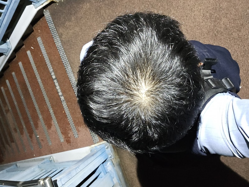 중3 인데 여러분들이 볼때는 어때요?(정수리)