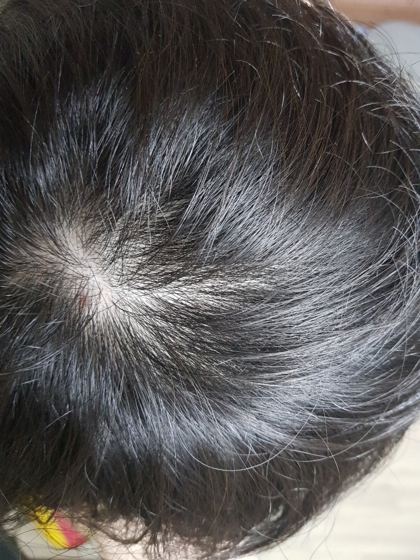 수술때문에 이틀만에 머리감은 직후인데..