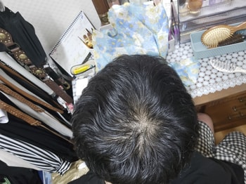 자고 일어나서 빗질 조금 한 머리 입니다...(10월23일)