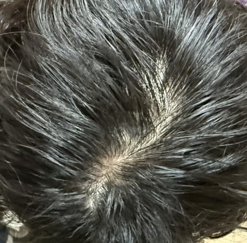 25년 10월 엘크라넬 바른 뒤