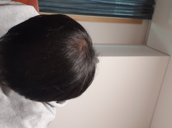 정수리는 어쩔수없네요 ㅋㅋㅋㅋ