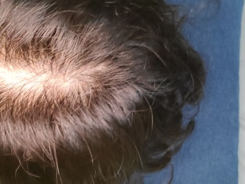 2020.05.22 : 5알파의 재공격