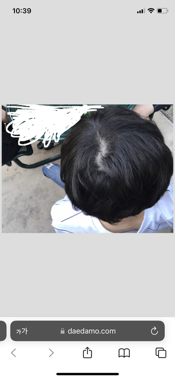 2017년 정수리 사진