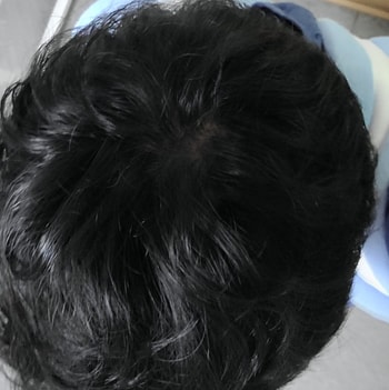 빛이 많이 솔리지 않는곳에서 정수리