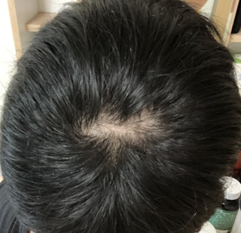 8/22. 로게인 시작일 - 후레쉬 터트리고 찍은 사진은 없네요ㅜ