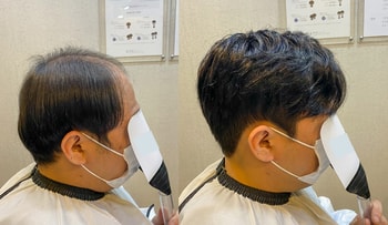 가르마펌 정측면