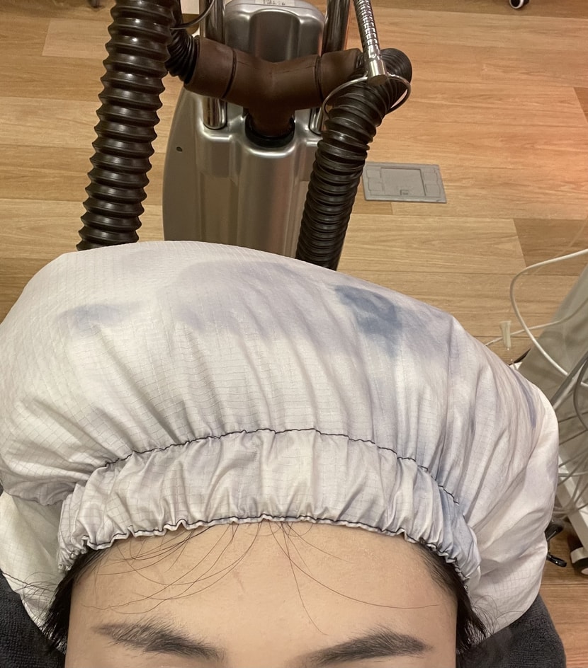 전체적인 1회 시술 후기 ! 일단 스케일링 너무 시원해서 다시 받고 싶고 ,,,,, 기분탓일수도 있지만 뭔가 모근이 튼튼해진 느낌 ?! ㅋㅋㅋ 선생님들이 너무 친절하시고 과정 과정마다 불편하진 않냐고 스윗하게 물어봐주셔서 기분좋게 치료 받았습니당 ! 