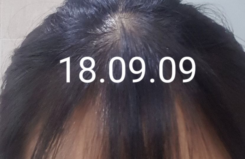 금방 좋아지지는 않아요