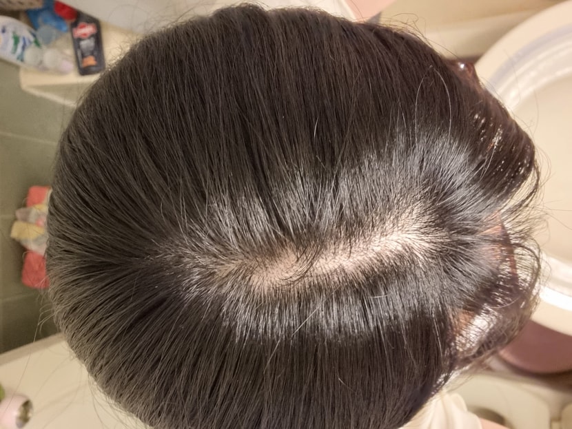 왼쪽가르마에요