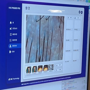 모발과 두피 상태 상담