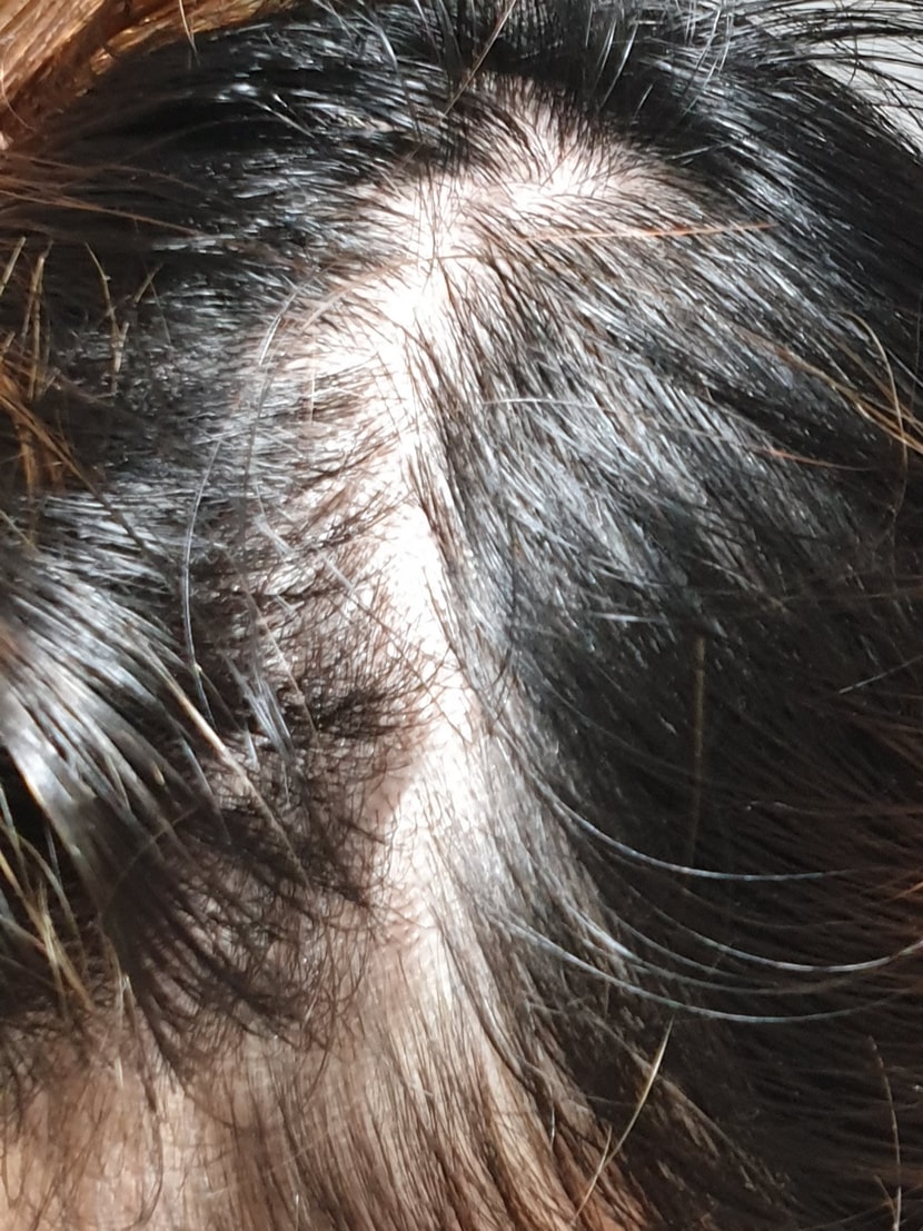 옆머리를 들추면