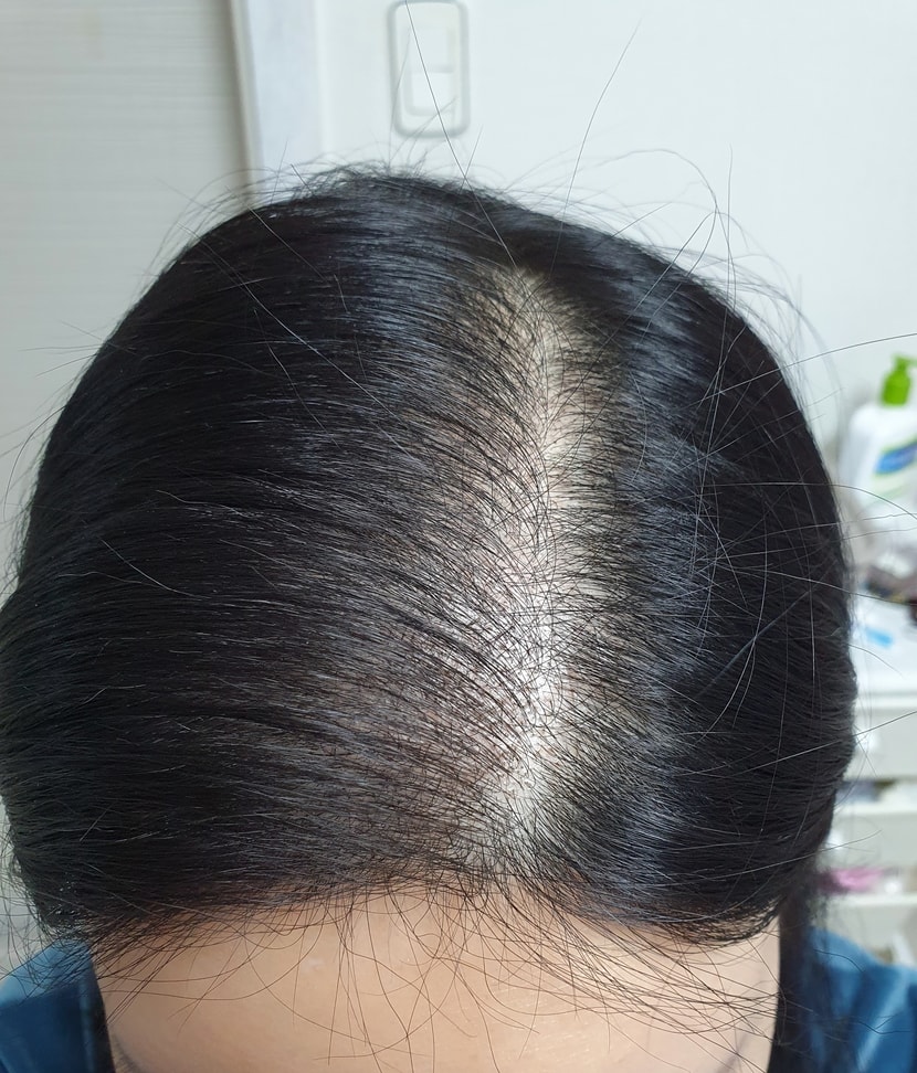 15일차
