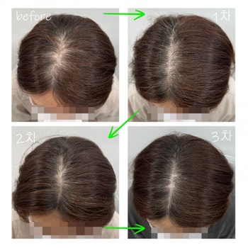 나의 머리 변천사..ㅠㅠ