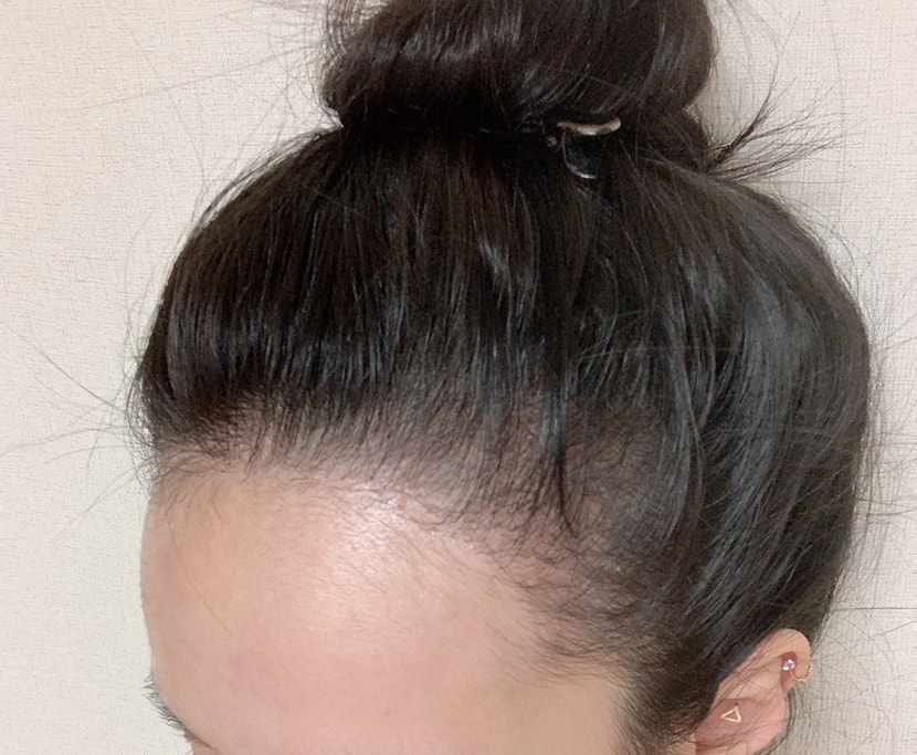 후
