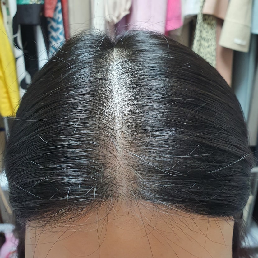 86일차 현재 정수리